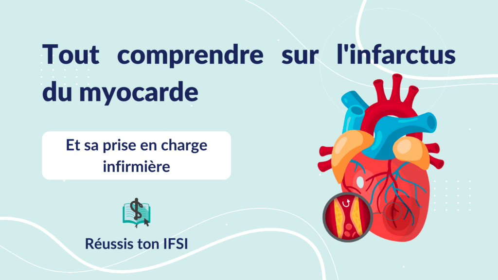 Vignette d'article - Tout comprendre sur l'infarctus du myocarde