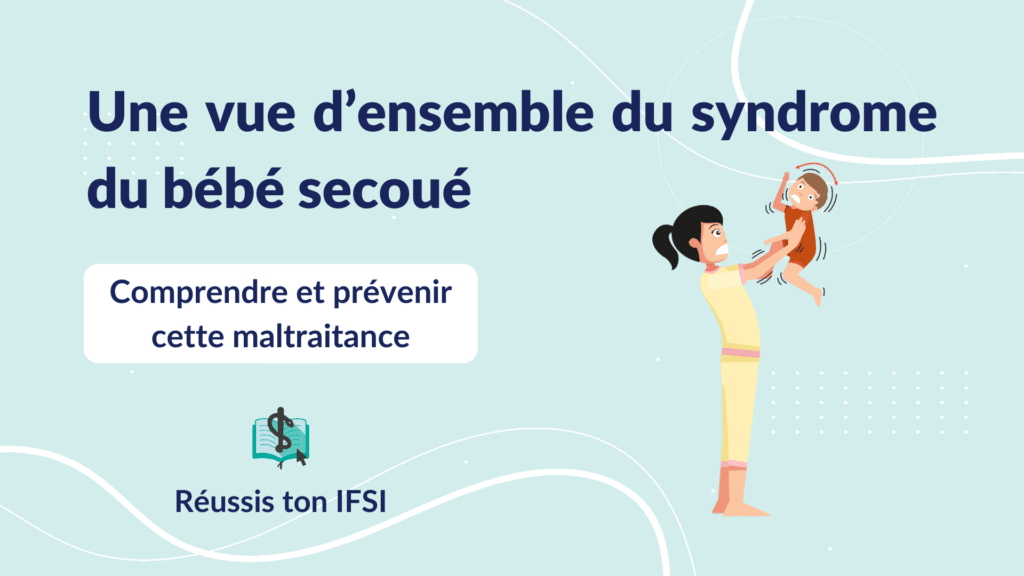 Vignette d'article - Syndrome du bébé secoué