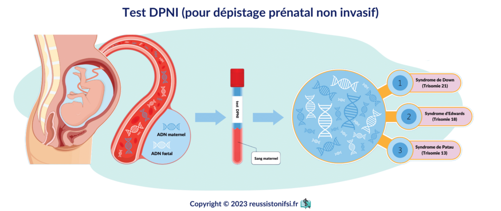 infographie - test DPNI (pour dépistage prénatal non invasif)