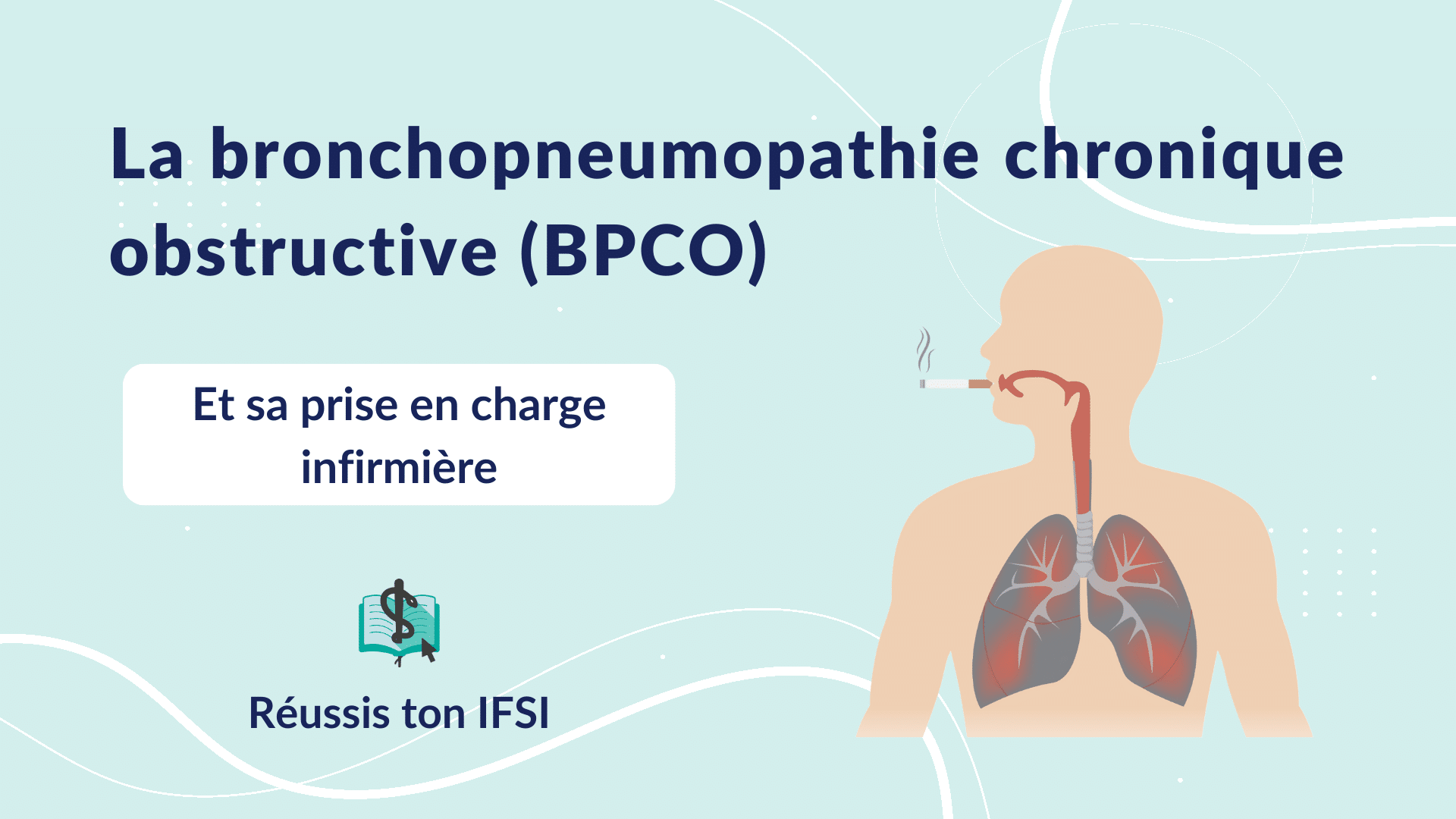 Vignette d'article - La bronchopneumopathie chronique obstructive (BPCO)