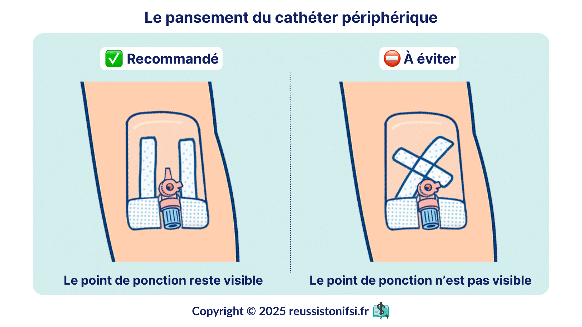 Infographie - Comment faire un pansement de cathéter périphérique ou perfusion