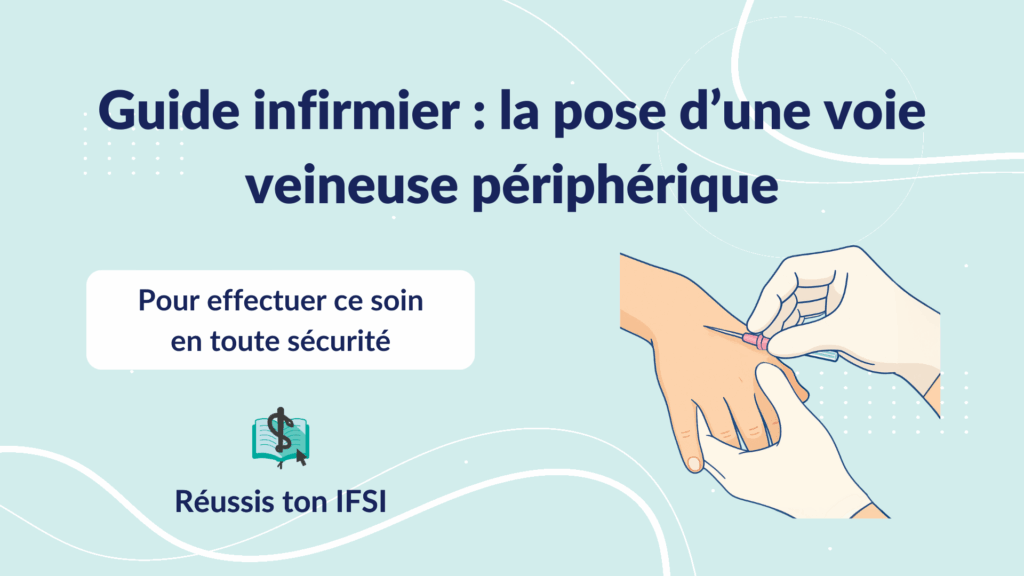 Vignette d'article - Guide infirmier pose voie veineuse périphérique (cathéter pour perfusion)