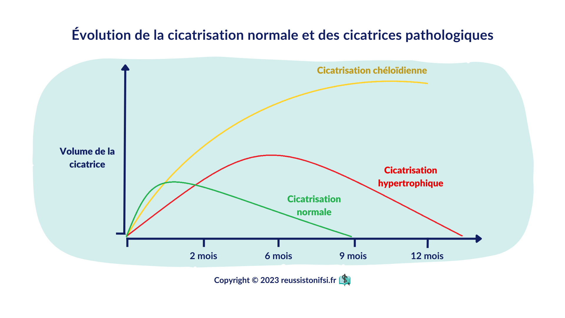 10 conseils pour la cicatrisation des plaies Réussis ton IFSI