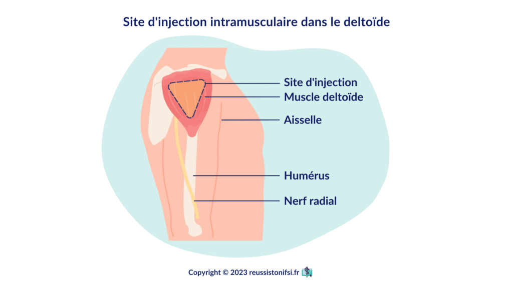 infographie - site d'injection intramusculaire dans le deltoïde