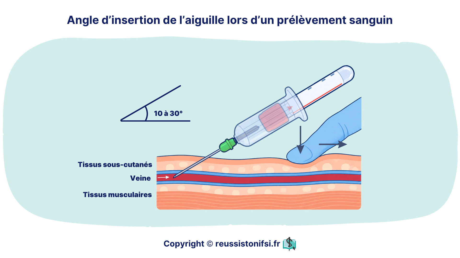 Angle d’insertion de l’aiguille de 10 à 30° lors d’un prélèvement sanguin veineux, avec schéma de la veine.