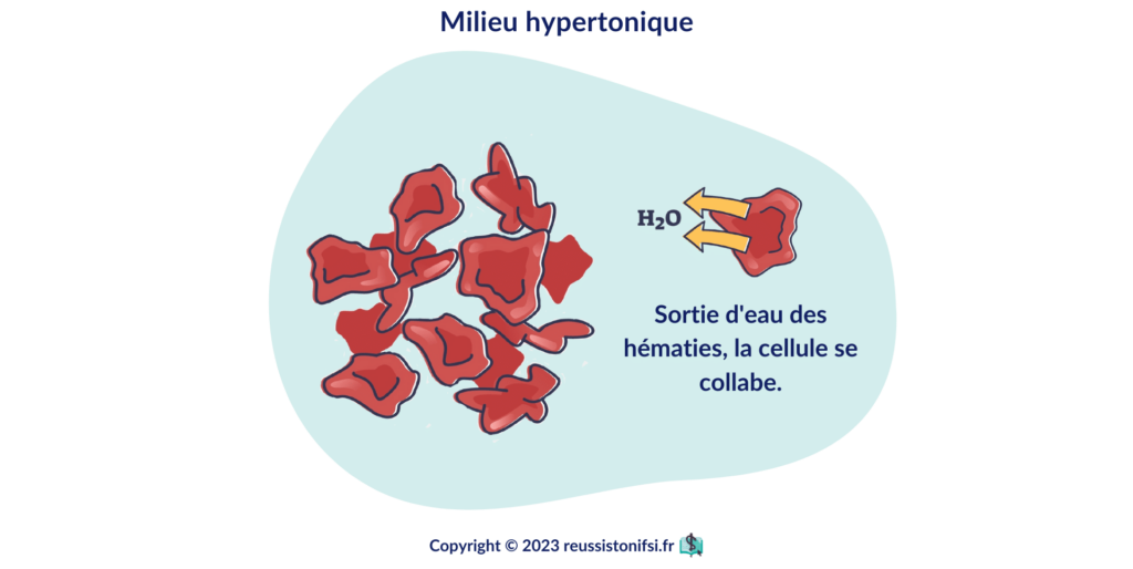 infographie - milieu hypertonique