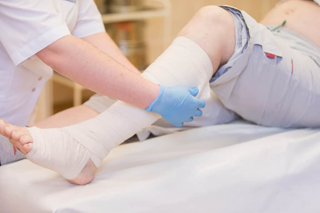 Nurse,Bandages,The,Leg.,Fracture,Of,Human,Lower,Limbs.,Treatment