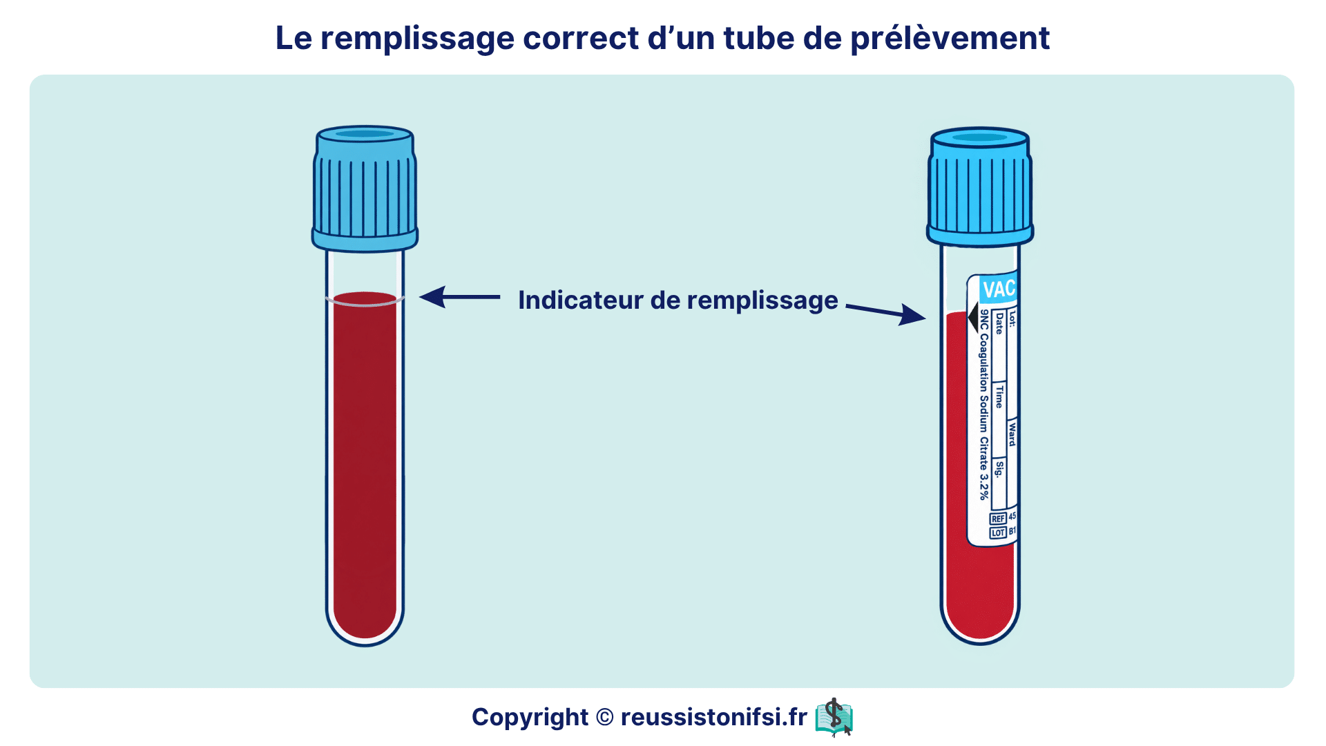 Remplissage correct d’un tube de prélèvement sanguin jusqu’à l’indicateur visible sur le tube ou son étiquette.