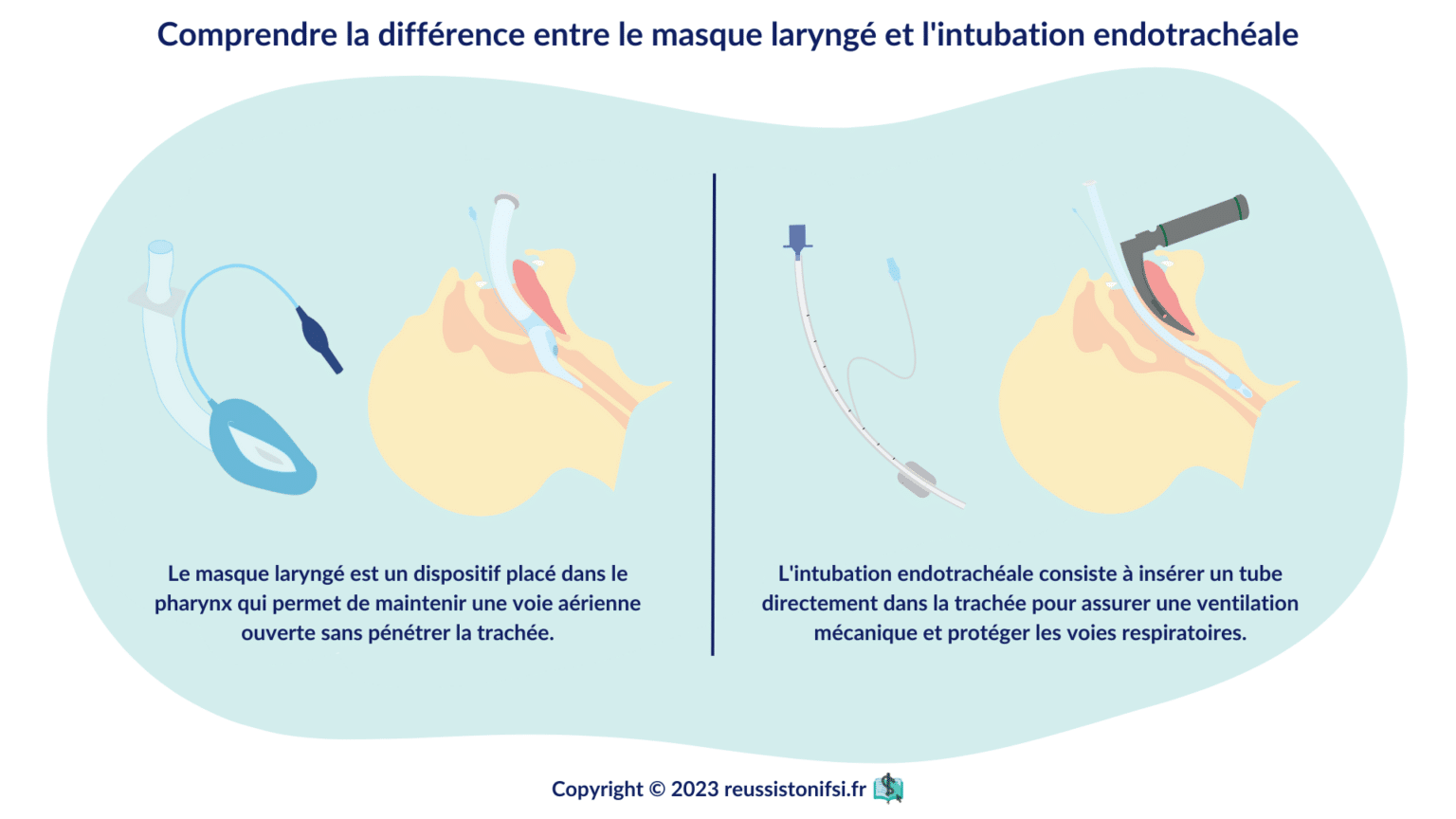 Guide Du Stage Infirmier En Sspi R Ussis Ton Ifsi