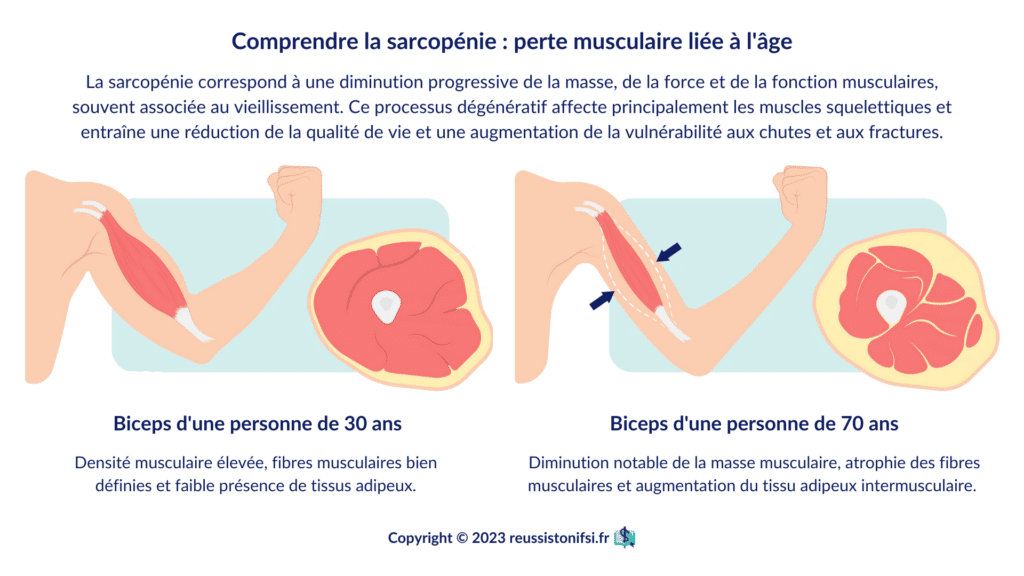 Infographie-Comprendre la sarcopénie _ perte musculaire liée à l'âge