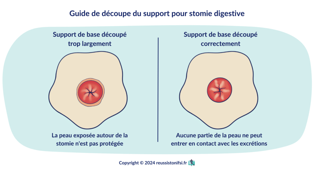 Infographie - Guide de découpe du support pour stomie digestive
