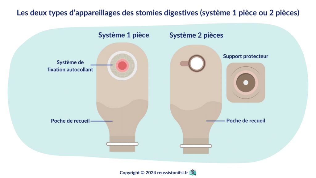 Infographie - Les deux types d’appareillages des stomies digestives (système 1 pièce ou 2 pièces)