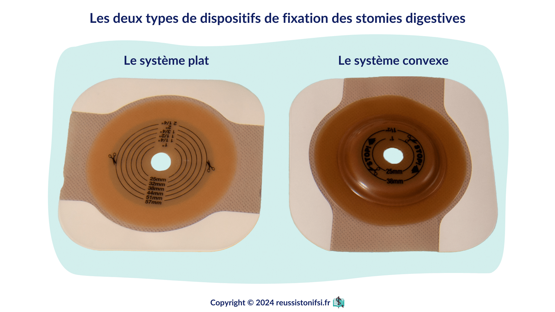 Guide infirmier les soins de colostomie et d