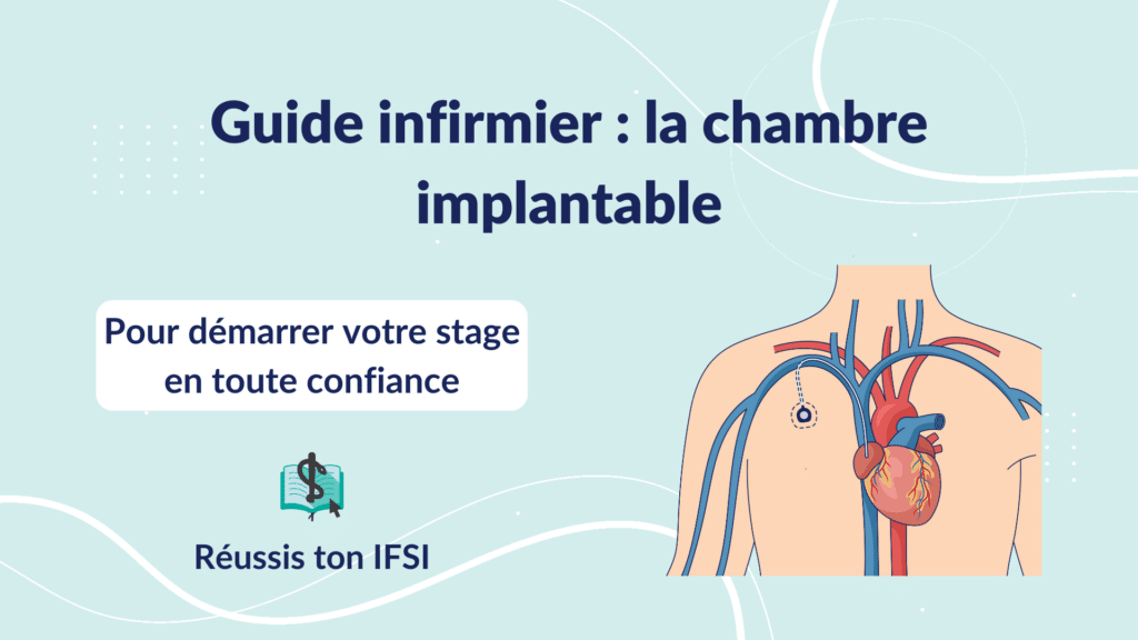 Vignette d'article - Guide infirmier _ la chambre implantable (CIP)