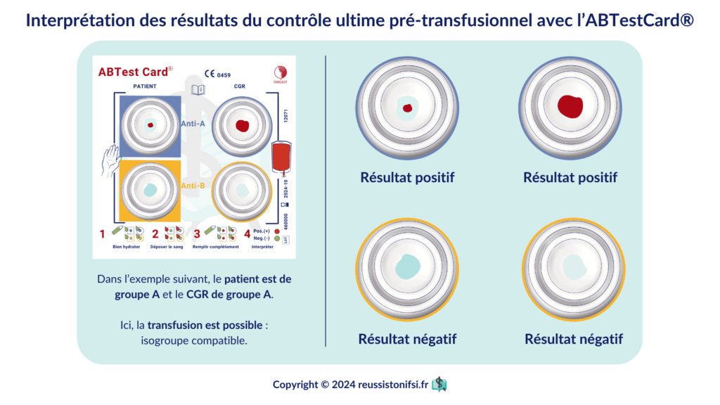 Infographie - Interprétation des résultats du contrôle ultime pré-transfusionnel avec l’ABTestCard®