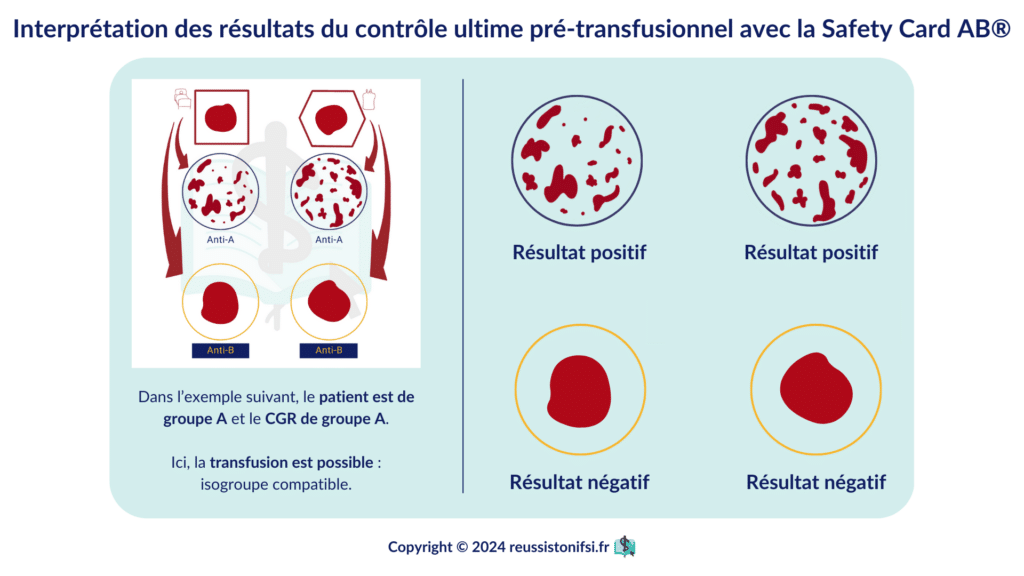 Guide infirmier : Le contrôle ultime pré-transfusionnel (CUPT)
