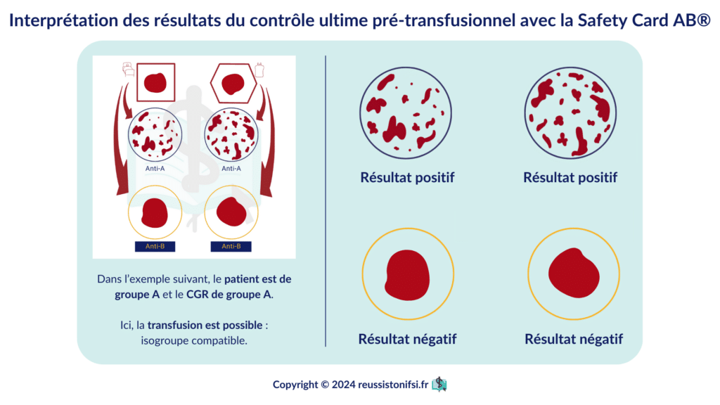 Infographie - Interprétation des résultats du contrôle ultime pré-transfusionnel avec la Safety Card AB®