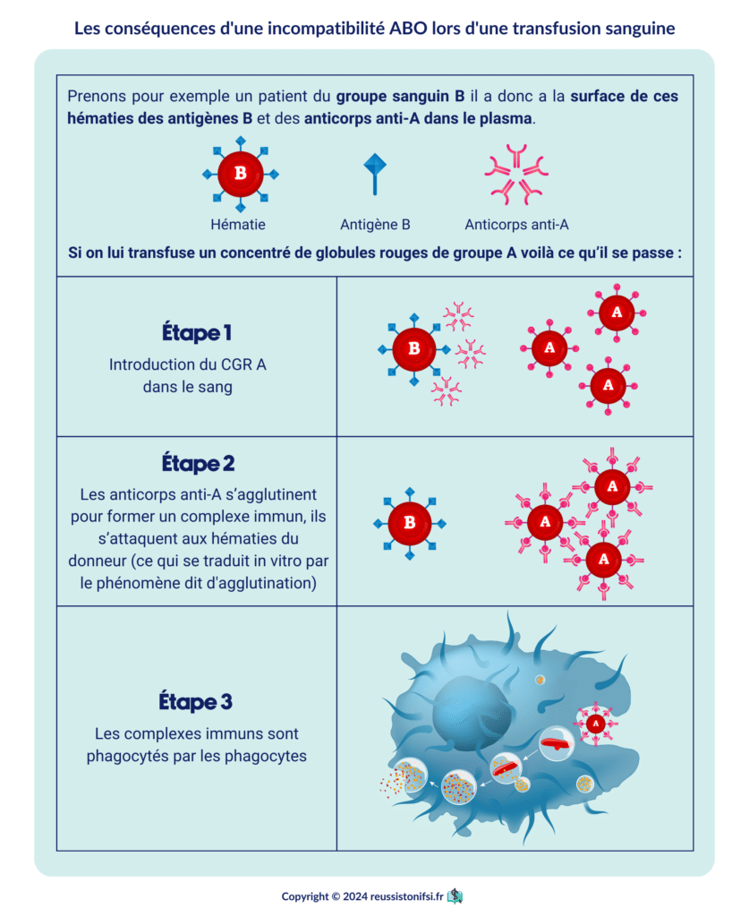 Infographie - Les conséquences d'une incompatibilité ABO lors d'une transfusion sanguine