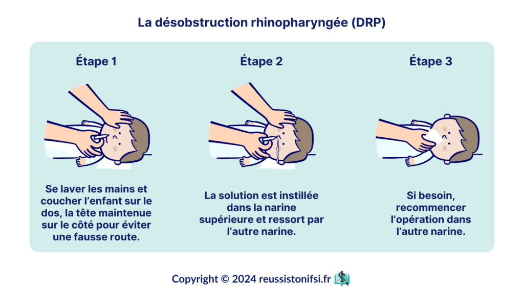 Infographie -La désobstruction rhinopharyngée (DRP)