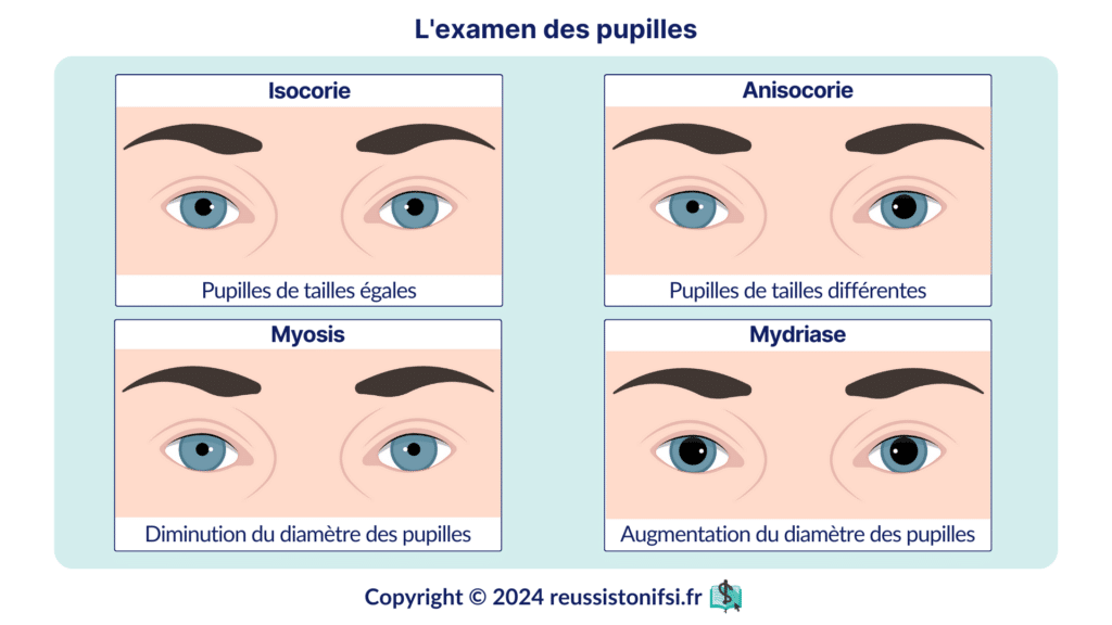 Infographie - l'examen des pupilles