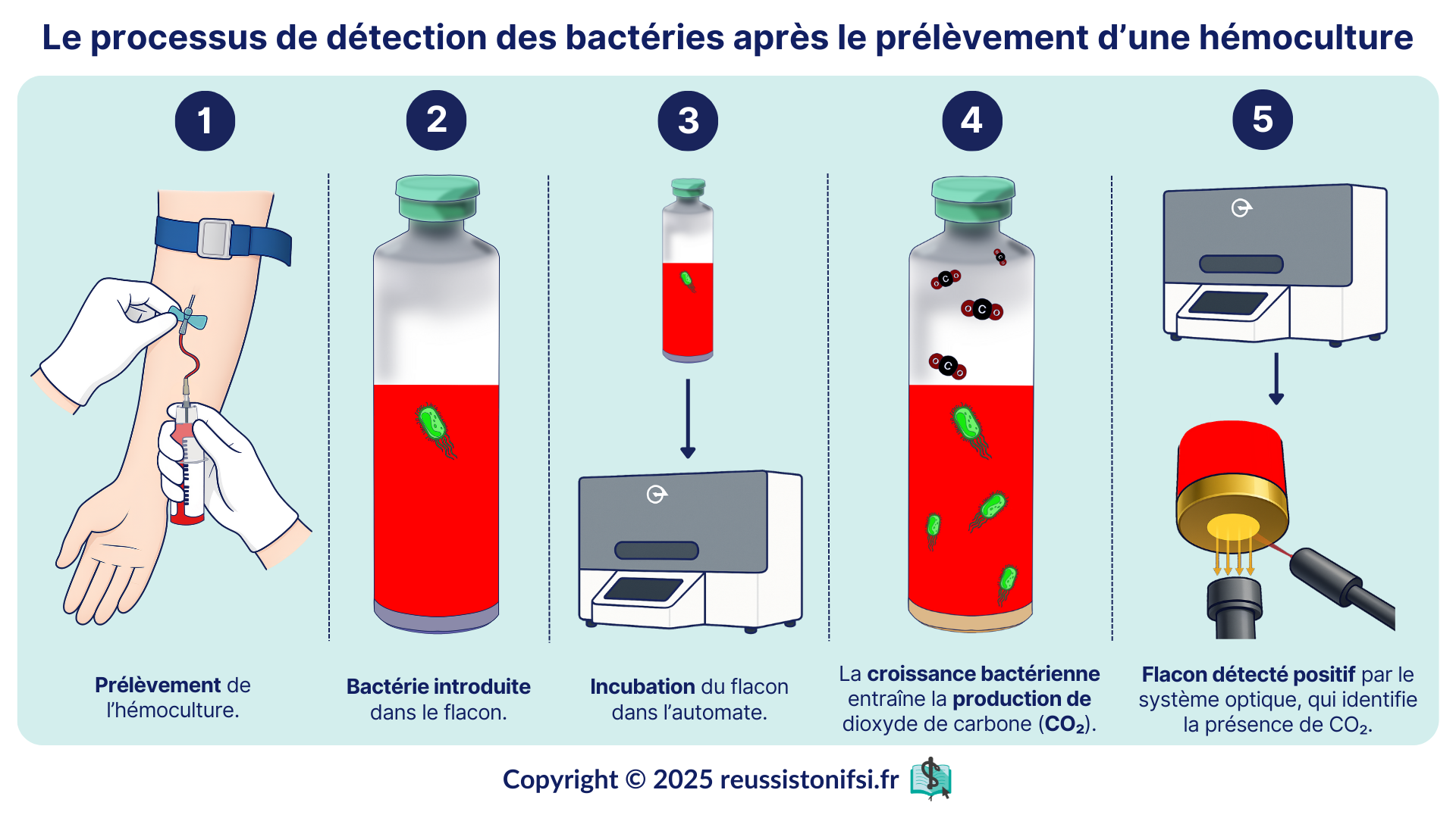 Infographie - Le processus de détection des bactéries après le prélèvement d’une hémoculture