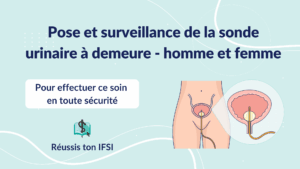 Illustration sur la pose et la surveillance d’une sonde urinaire à demeure chez l’homme et la femme, avec schéma de la vessie et du dispositif.