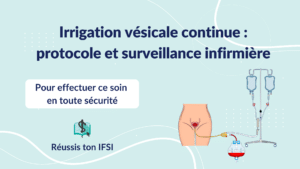 Irrigation vésicale continue illustrant montage, poches d’irrigation et sonde 3 voies pour les soins infirmier(e)