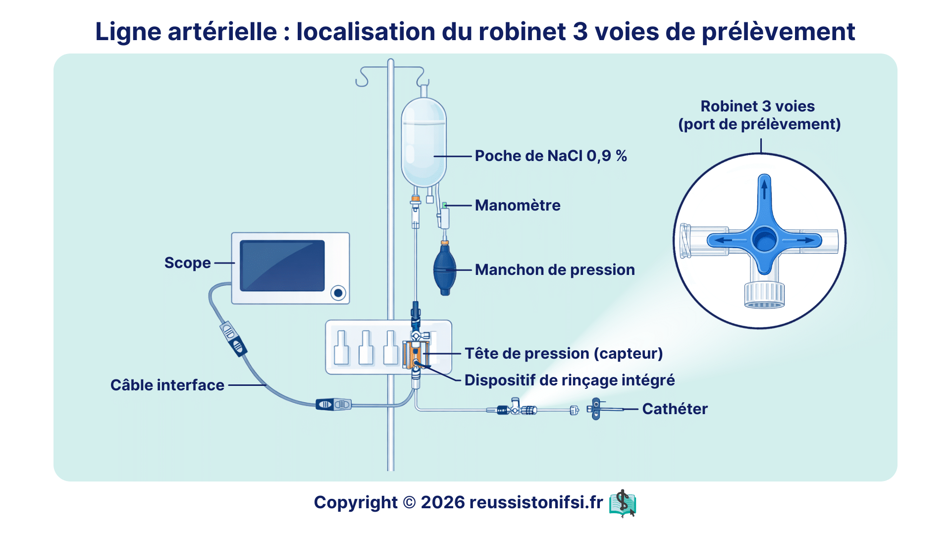 Robinet 3 voies sur ligne artérielle reliée au capteur de pression et au cathéter pour prélèvement sanguin et surveillance hémodynamique