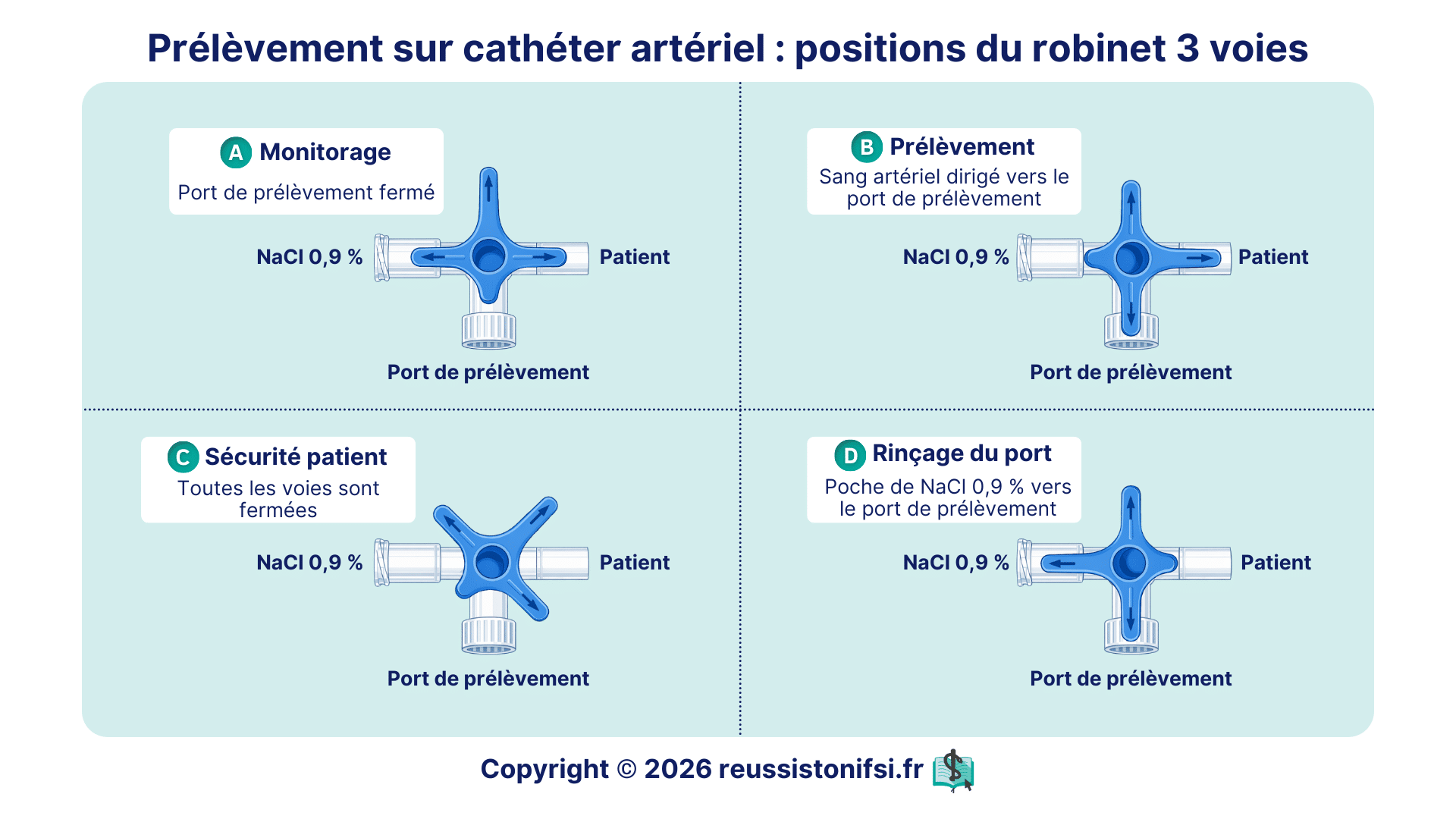 Schéma des positions du robinet 3 voies sur ligne artérielle pour monitorage, prélèvement sanguin et rinçage au NaCl 0,9 %