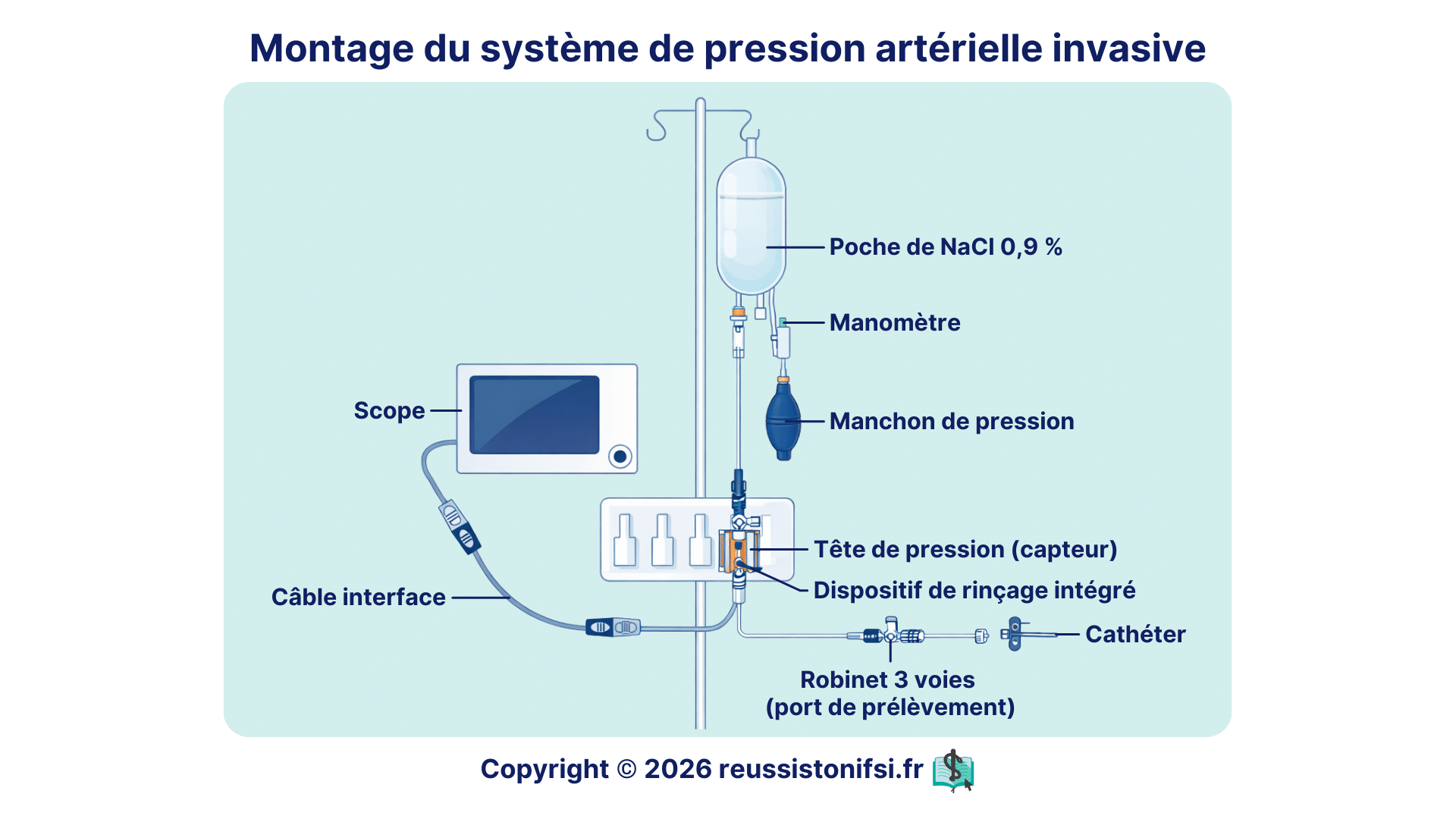 Montage du système de pression artérielle invasive avec poche de NaCl 0,9 %, capteur, manchon et cathéter artériel relié au scope