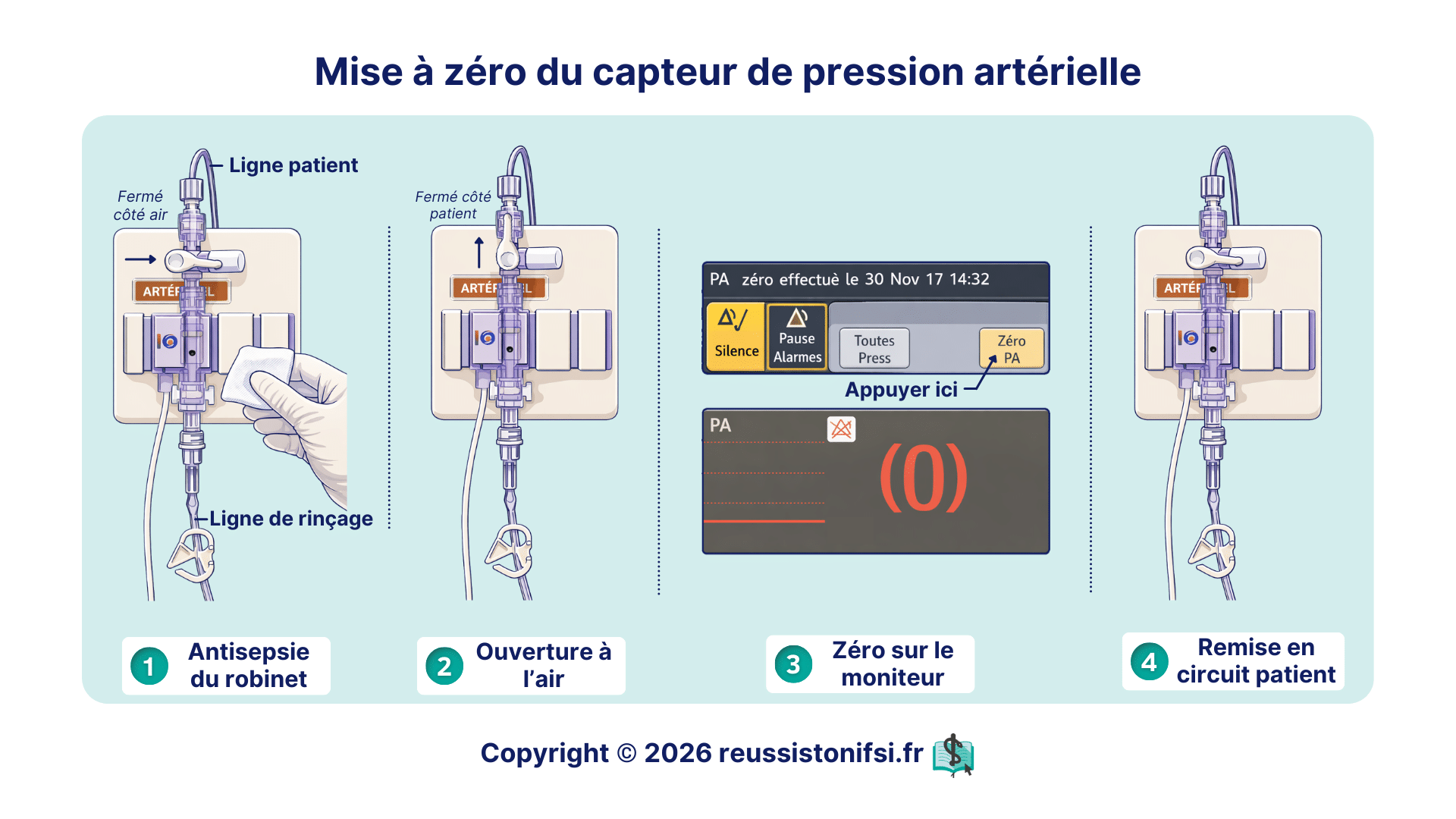 Réalisation du zéro du capteur de pression artérielle avec ouverture à l’air, robinet 3 voies et validation sur le moniteur