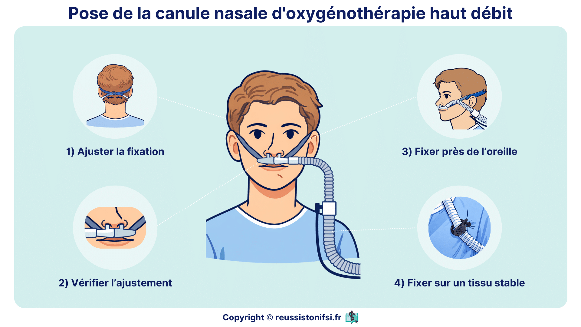 Installation d’une canule nasale haut débit avec ajustement des embouts, fixation auriculaire et stabilisation du circuit d’oxygénothérapie