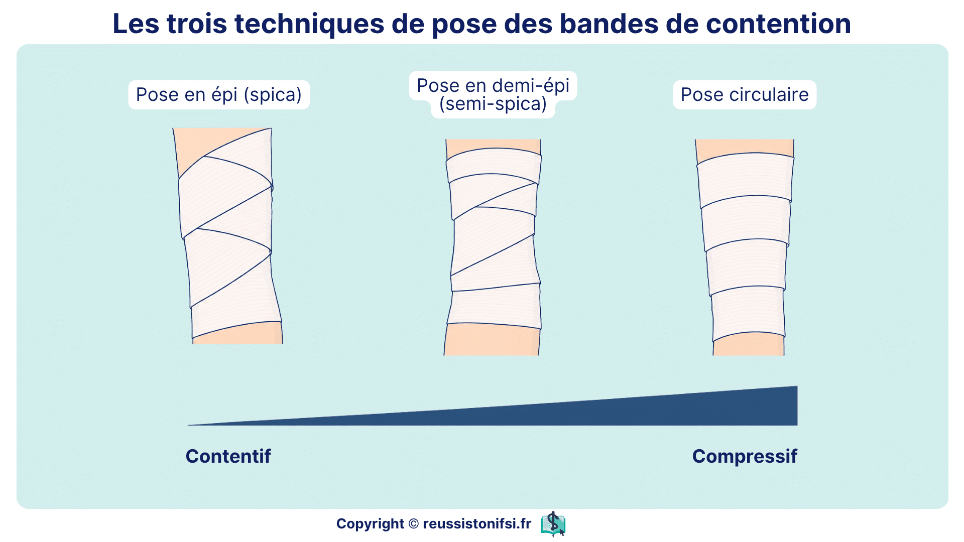 Techniques de pose des bandes de contention montrant les poses en épi, demi-épi et circulaire compressive.