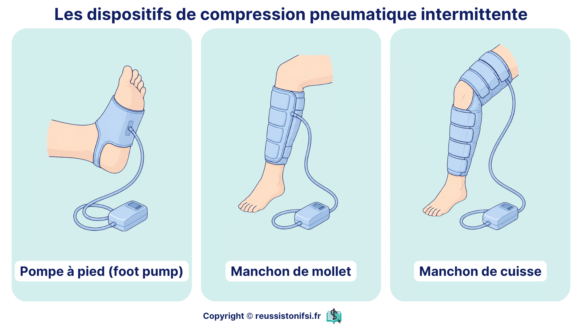 Dispositifs de compression pneumatique intermittente avec pompe à pied et manchons de mollet ou de cuisse.