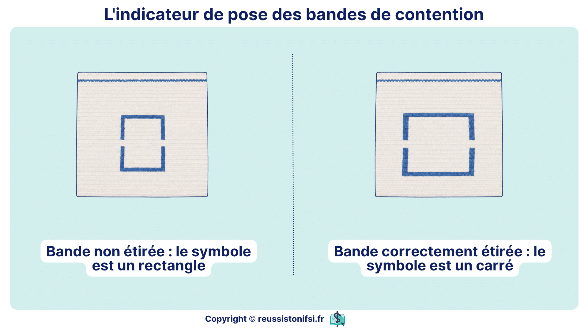 Indicateur de pose des bandes de contention montrant la différence entre bande non étirée et correctement étirée.