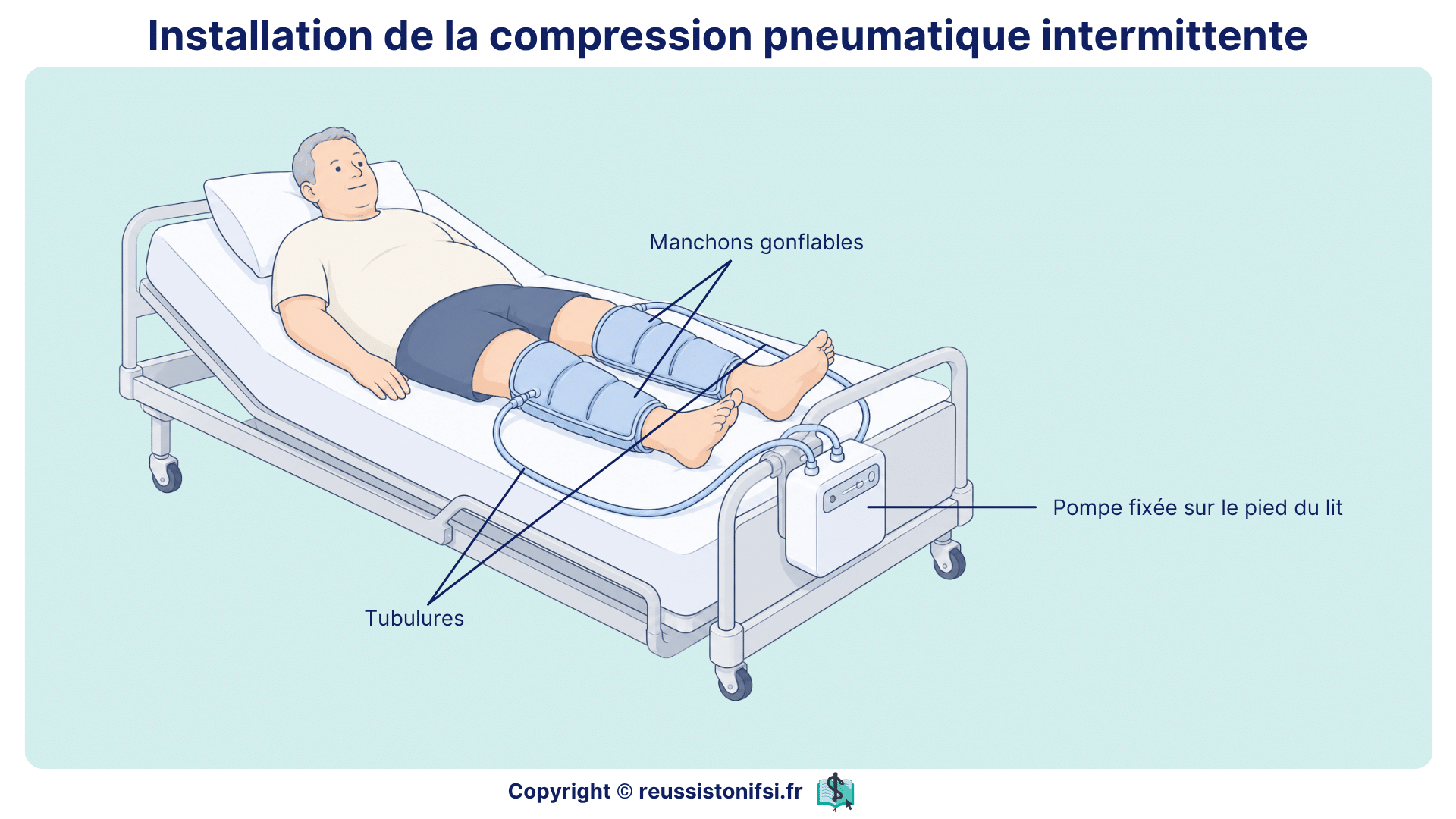 Installation de compression pneumatique intermittente avec manchons gonflables et pompe reliée au lit du patient.