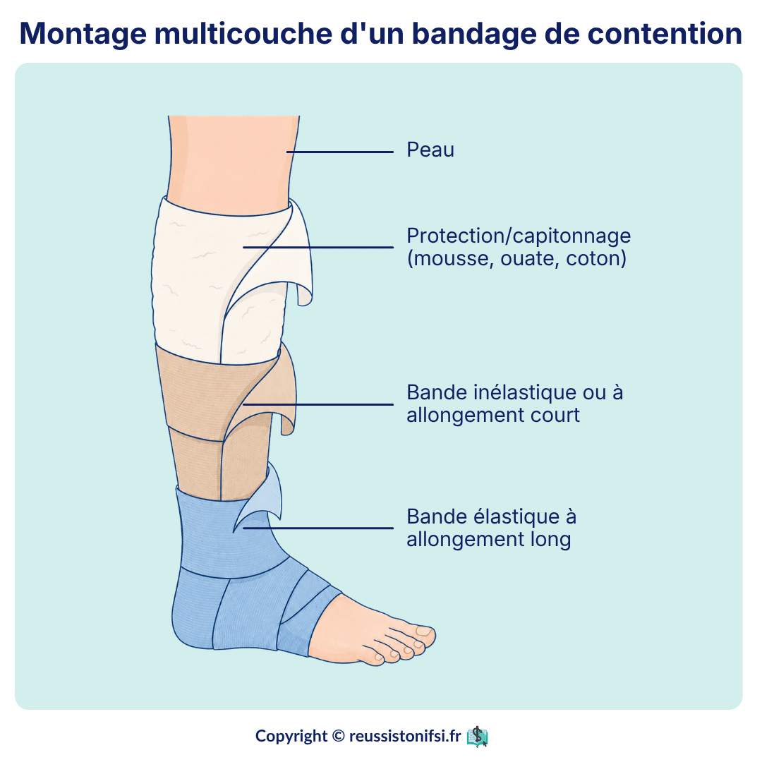 Montage multicouche d’un bandage de contention avec protection, bande inélastique et bande élastique sur la jambe.
