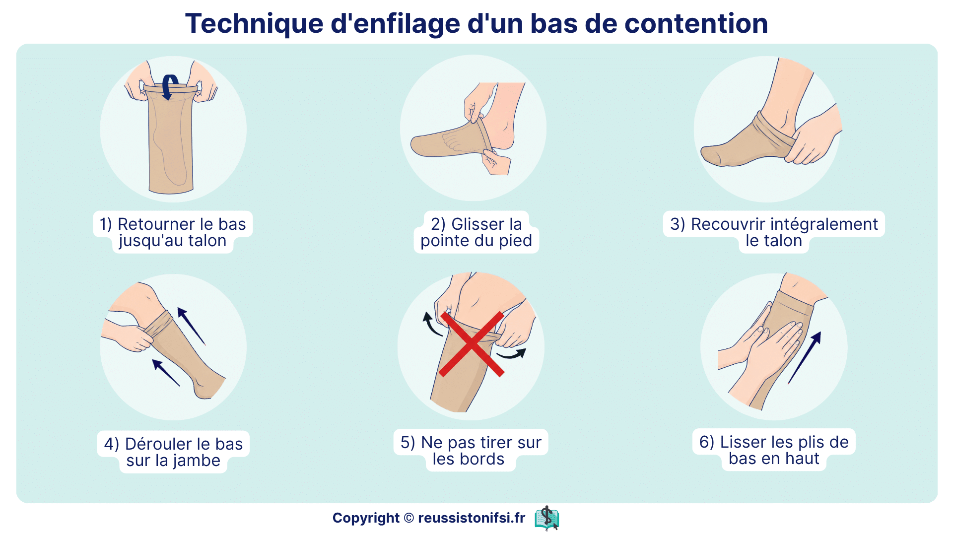 Technique d’enfilage d’un bas de contention montrant les étapes de mise en place correcte sur la jambe du patient.