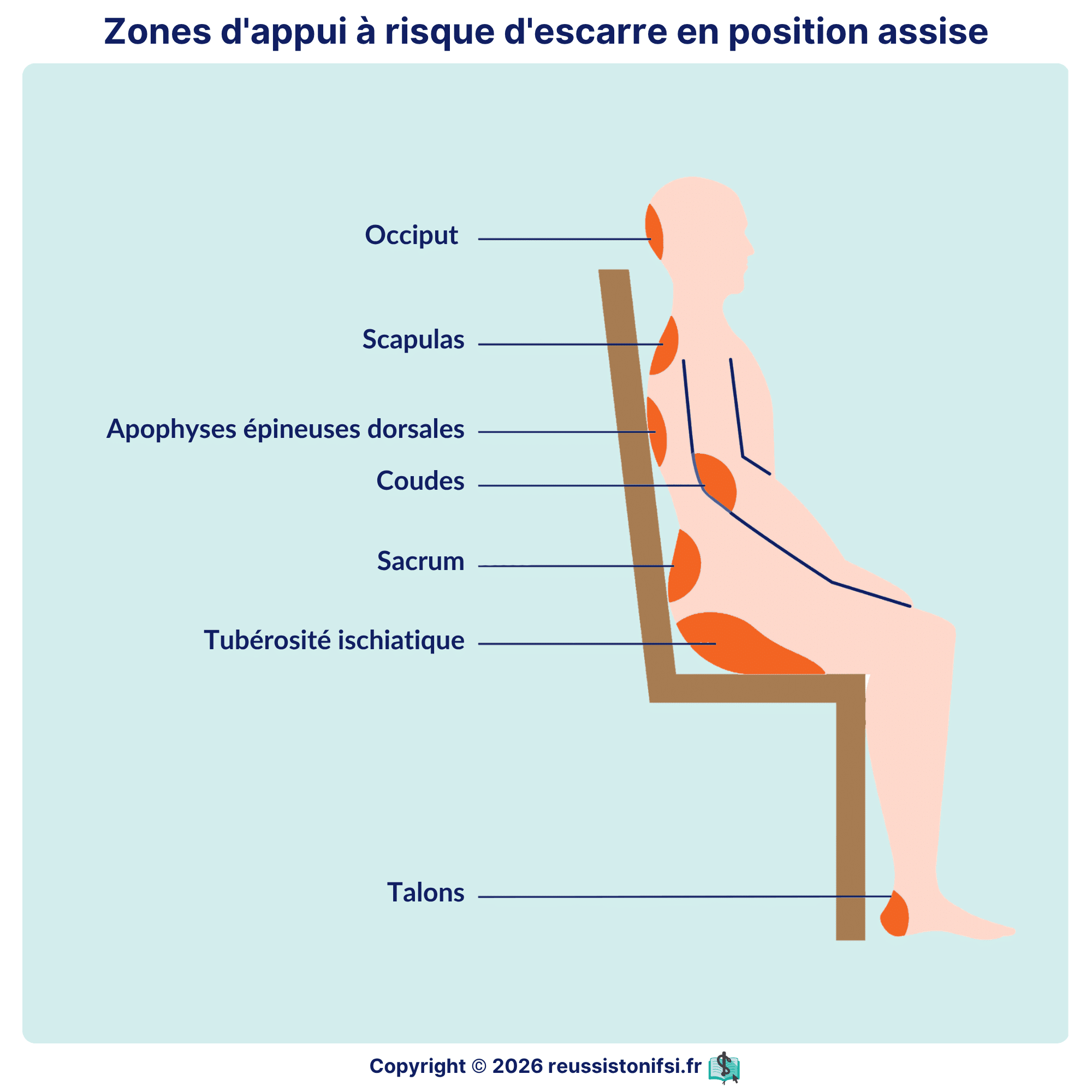Zones d’appui à risque d’escarre en position assise : occiput, scapulas, sacrum, ischions et talons.
