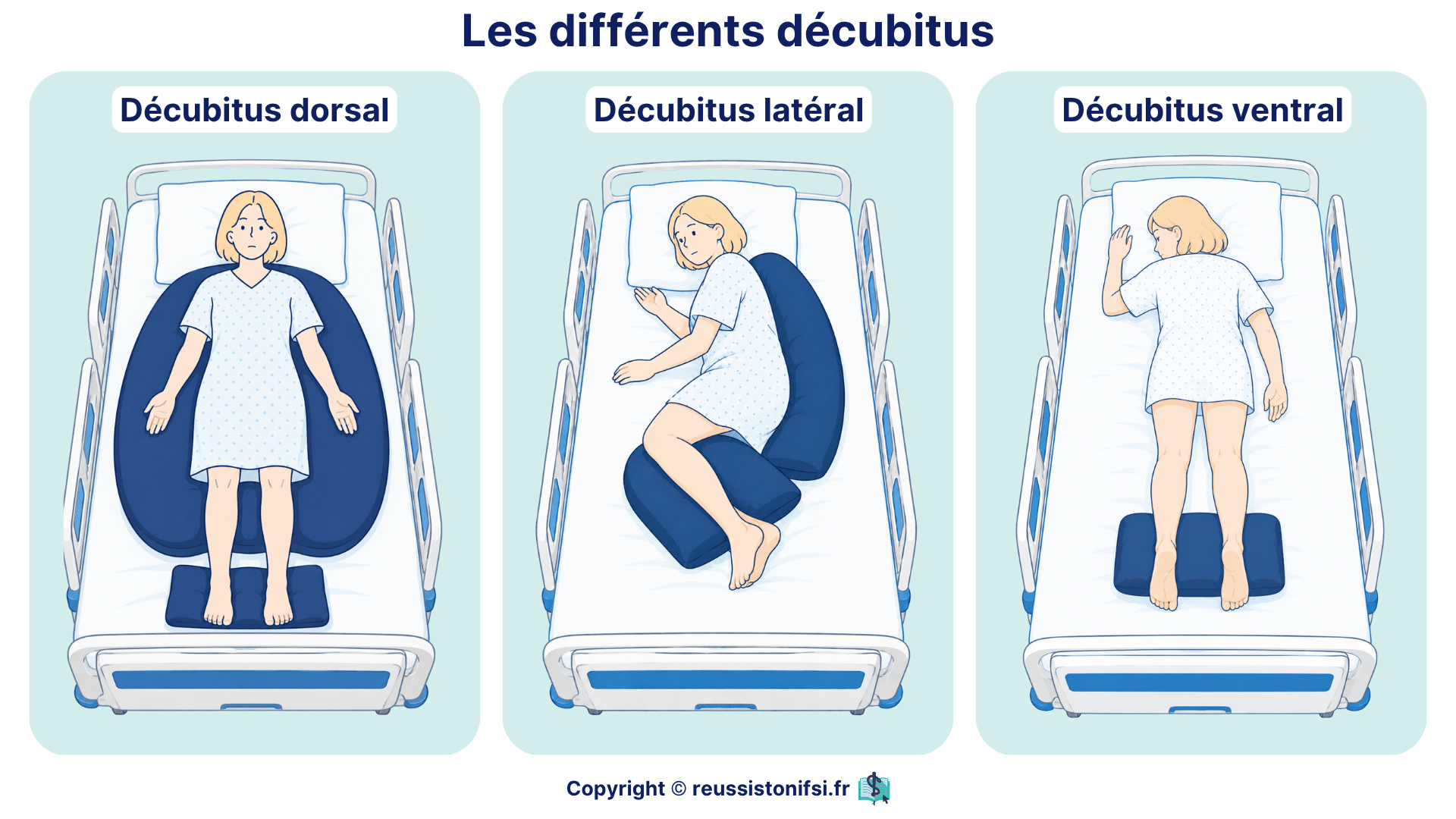 Différents décubitus : positions dorsale, latérale et ventrale pour le positionnement du patient alité.