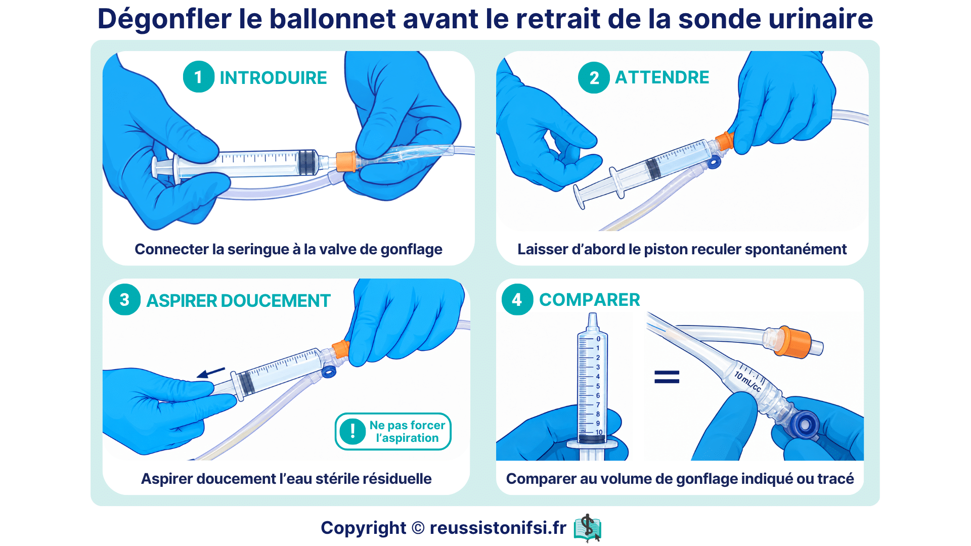 Dégonfler ballonnet sonde urinaire : étapes pour connecter, attendre, aspirer et comparer le volume.