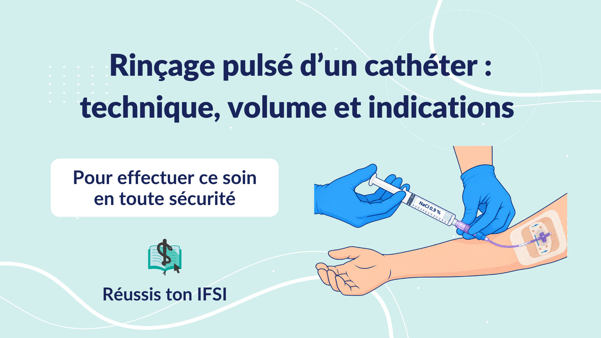 Rinçage pulsé d’un cathéter : seringue raccordée au prolongateur d’un accès veineux posé sur le bras du patient.